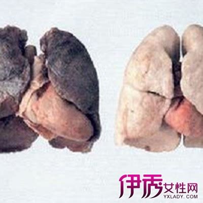 砂肺是什麼 2月23日出生的人